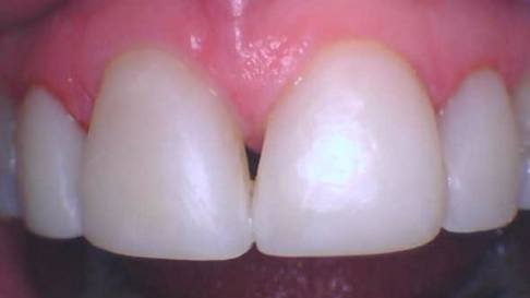 Bright healthy smile after dental treatment