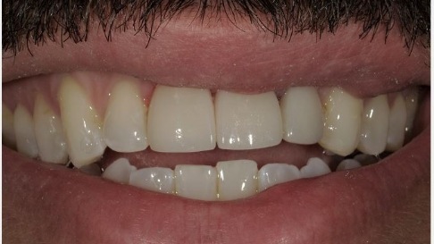 Healthy smile after dental treatment