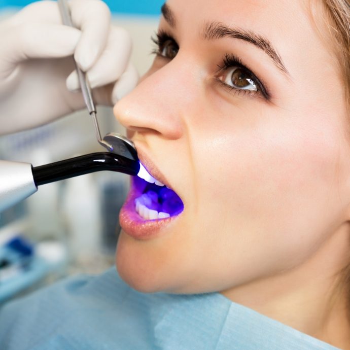 Patient receiving cosmetic dental bonding