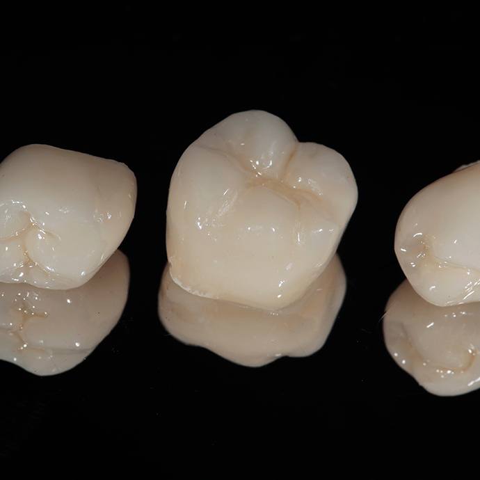 Closeup of a dental crown