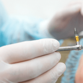 Closeup of dental implant surgeon holding a dental implant