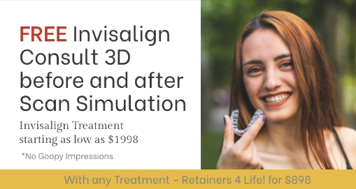 Woman with clear aligner next to text about free Invisalign consultation