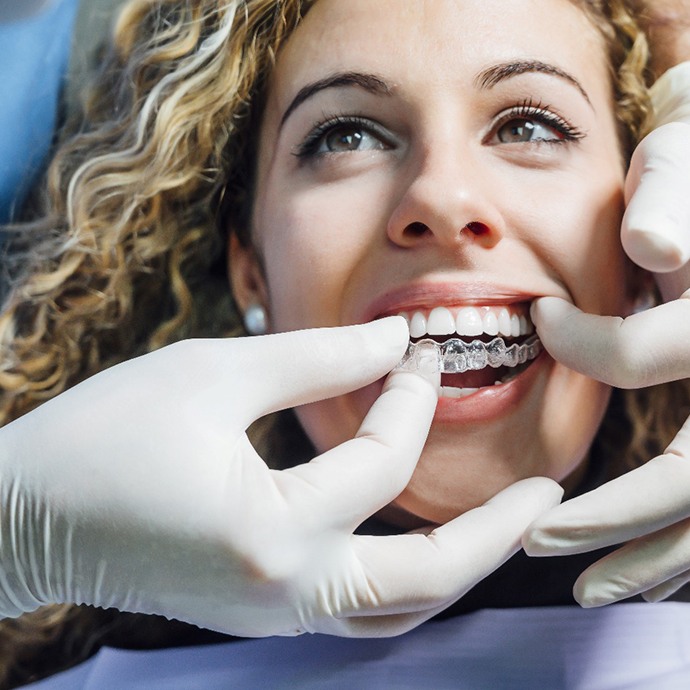 Closeup of patient being fitted for Invisalign in Longmont