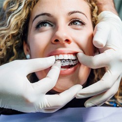Longmont dentist placing Invisalign aligner on patient