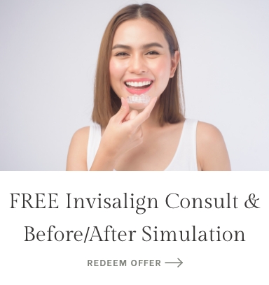 Free Invisalign Consultation