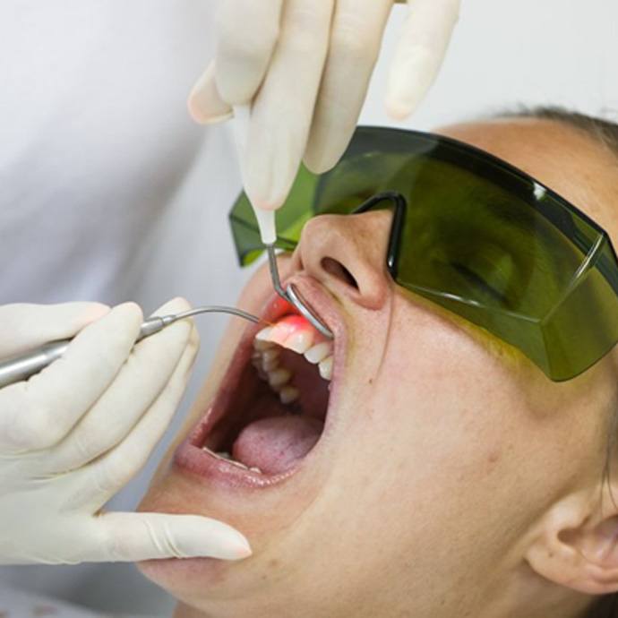a patient undergoing LANAP surgery to treat gum disease