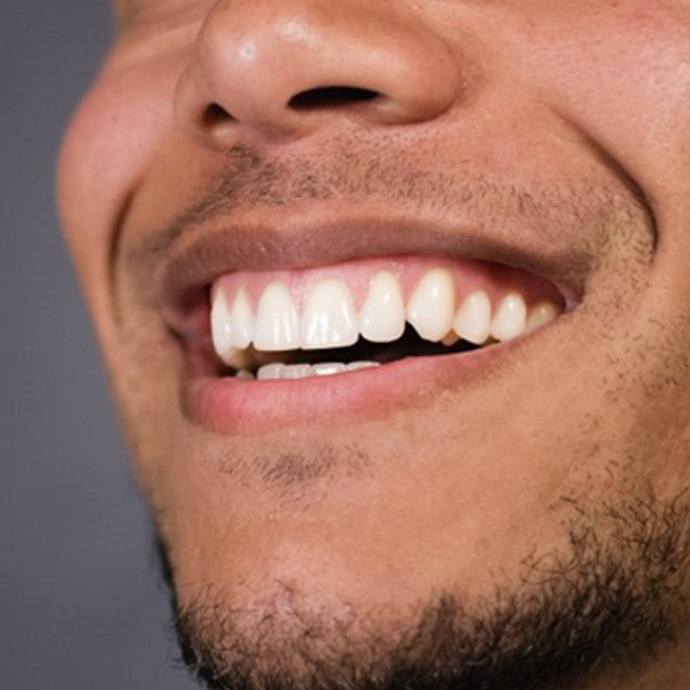 a man smiling with healthy gums