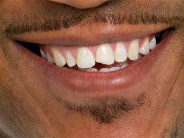 woman smiling with dentist