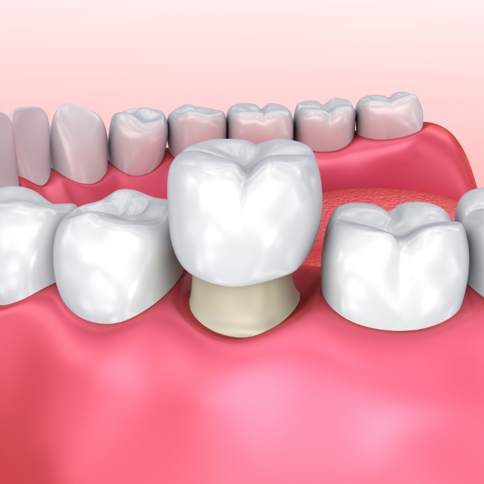 Animated smile with dental crown restoration