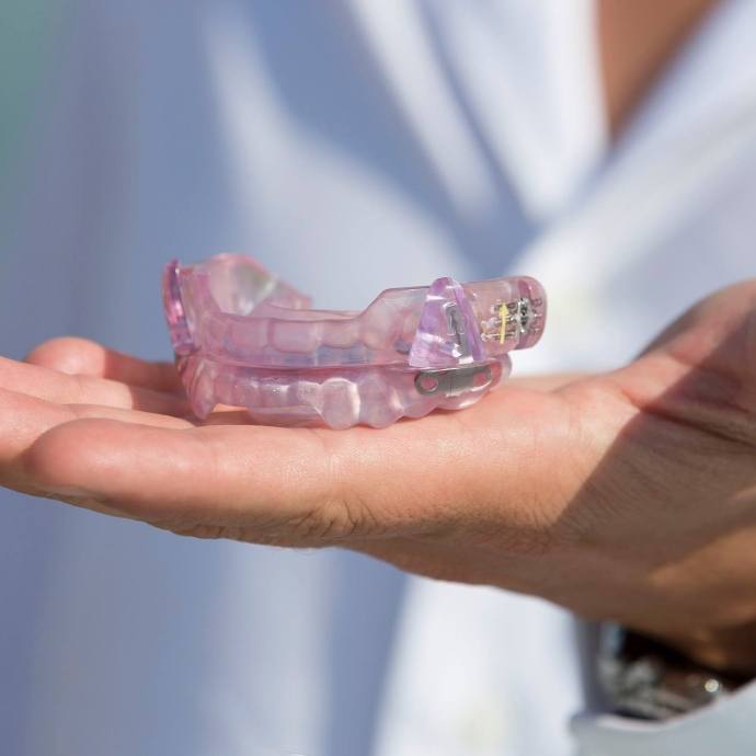 Patient holding an oral appliance for sleep apnea treatment