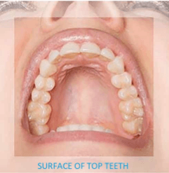 Close up of the top teeth from below