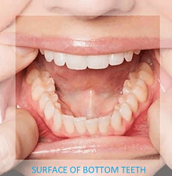 Close up of the bottom teeth from above