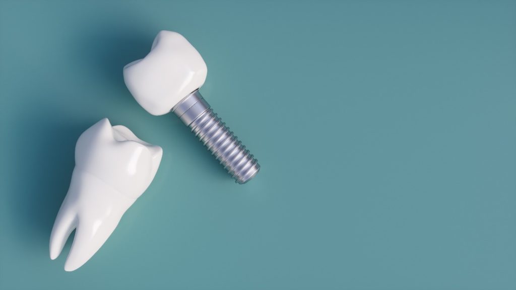 closeup of two dental implants